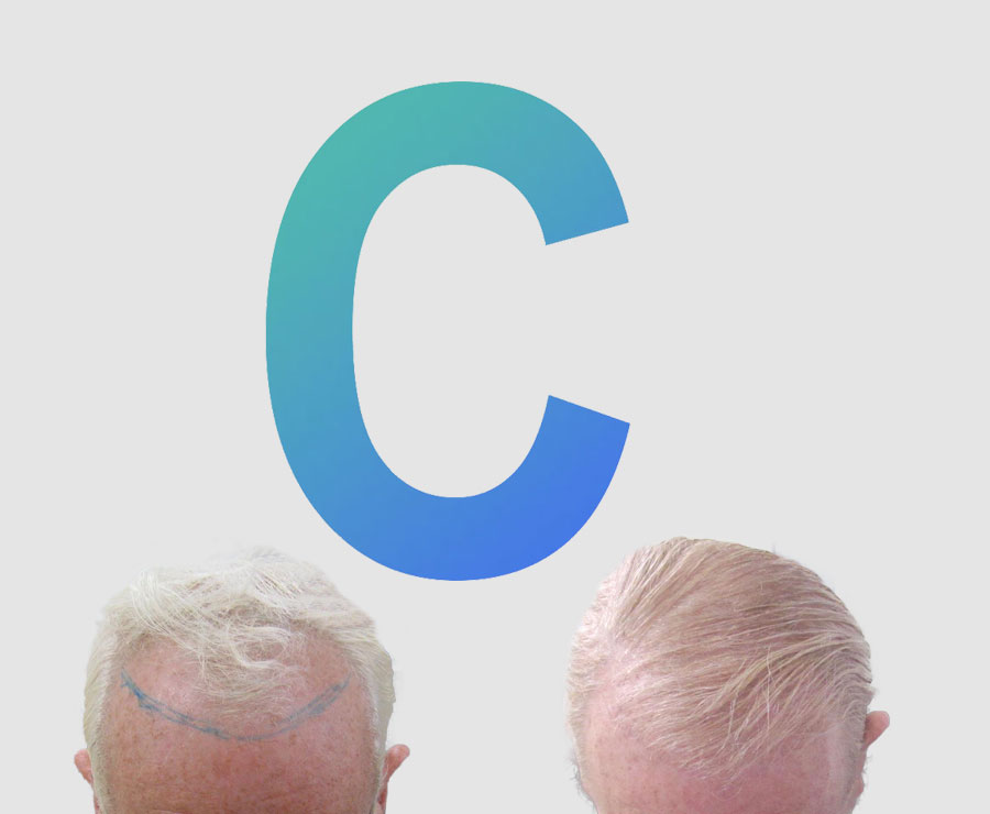 C